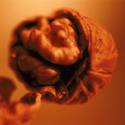 Diet & Nutrition related image